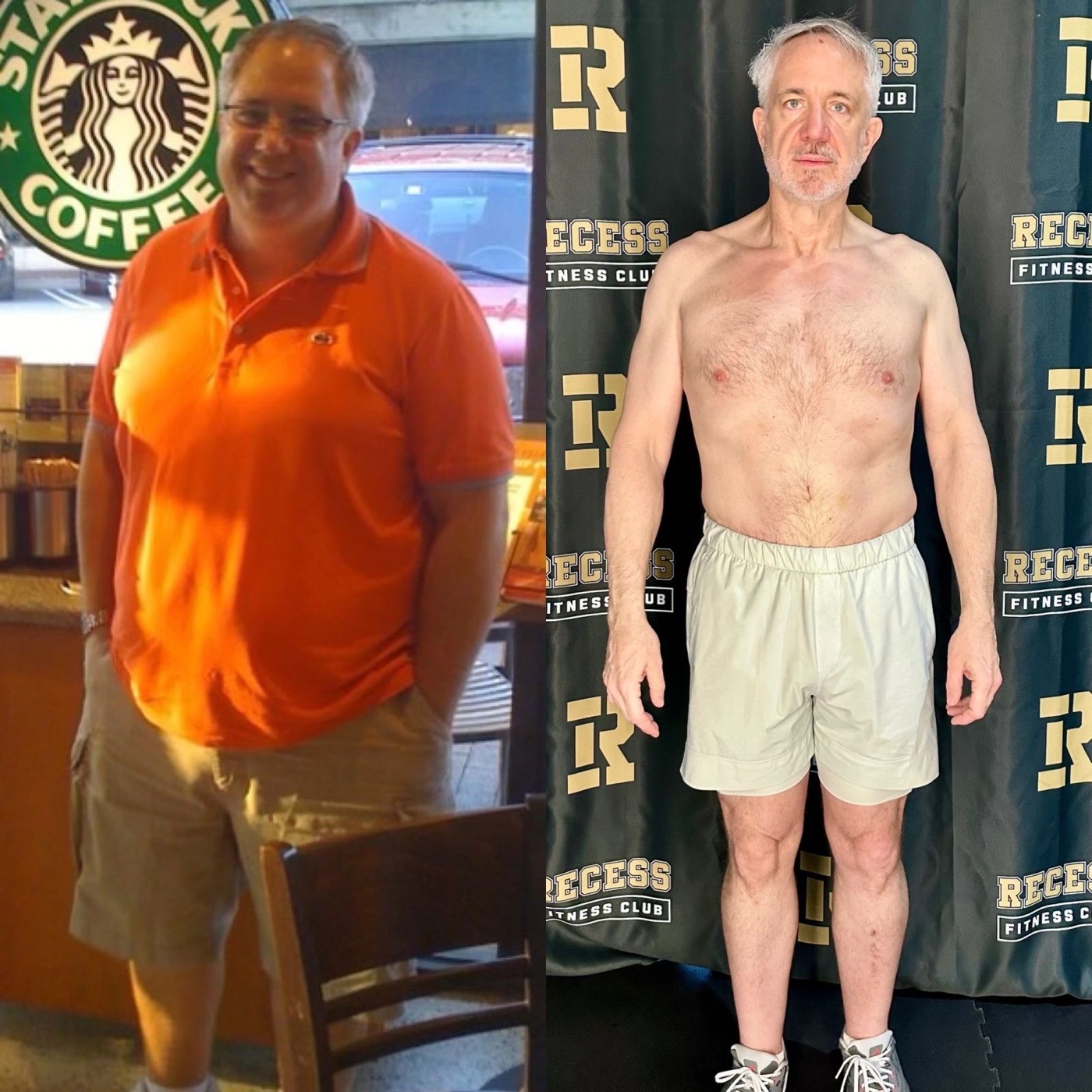 Male client before and after a dramatic weight-loss transformation.
